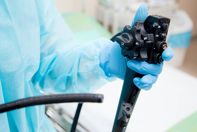 内視鏡を操作する医師の手元