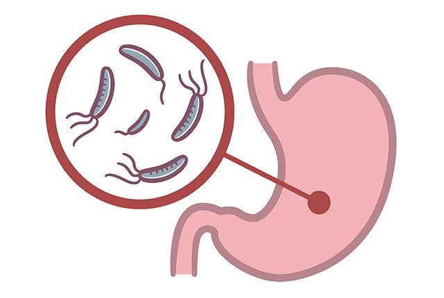胃のなかにピロリ菌がいるイメージ図