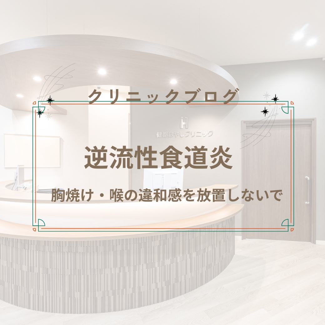 逆流性食道炎　～胸焼け・喉の違和感を放置しないで～